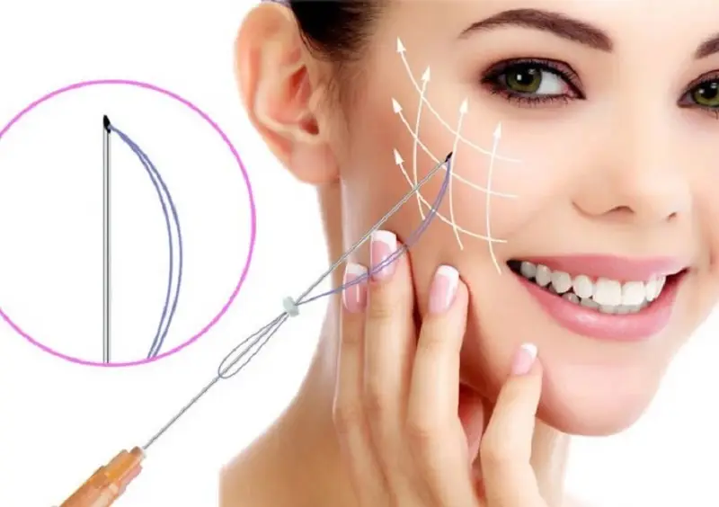 Căng chỉ da mặt có thể xảy ra nguy hiểm nếu bác sĩ thực hiện không đúng kỹ thuật