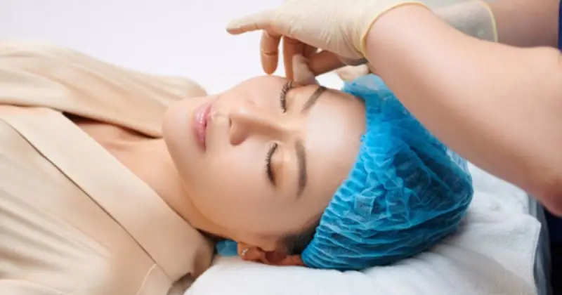 Sử dụng loại chỉ căng da chất lượng cao