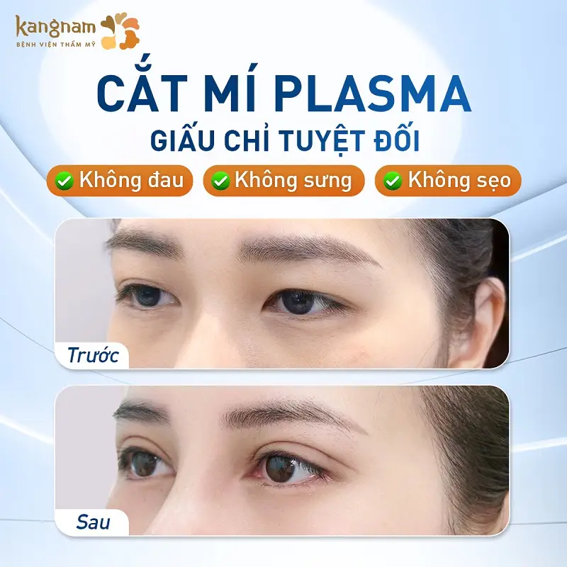 Kangnam ứng dụng đa dạng các công nghệ cắt mí