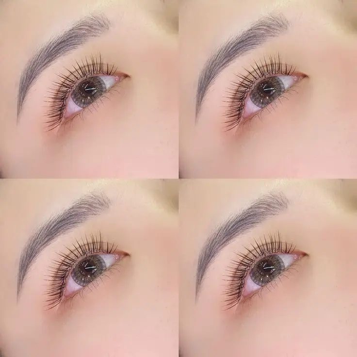 Khách hàng nối mi sau khi vết thương cắt mí đã phục hồi