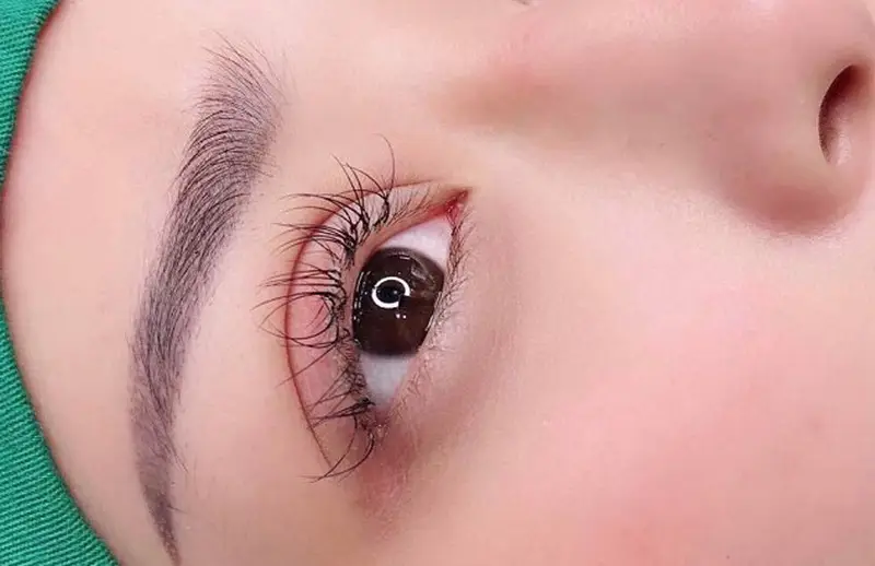 Không nên nối mi quá sớm sau cắt mí có thể làm vết thương lâu hồi phục