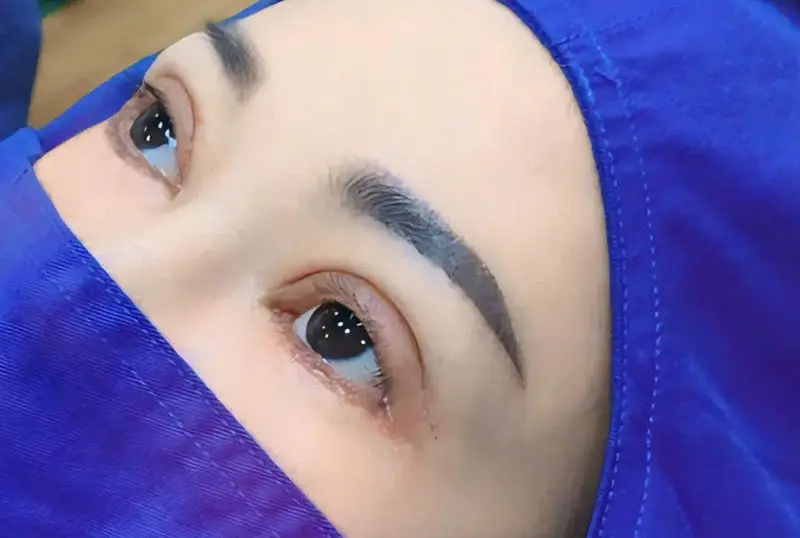 Một dáng mí đẹp sau khi cắt mí phải cân đối, hài hòa với các đường nét trên khuôn mặt