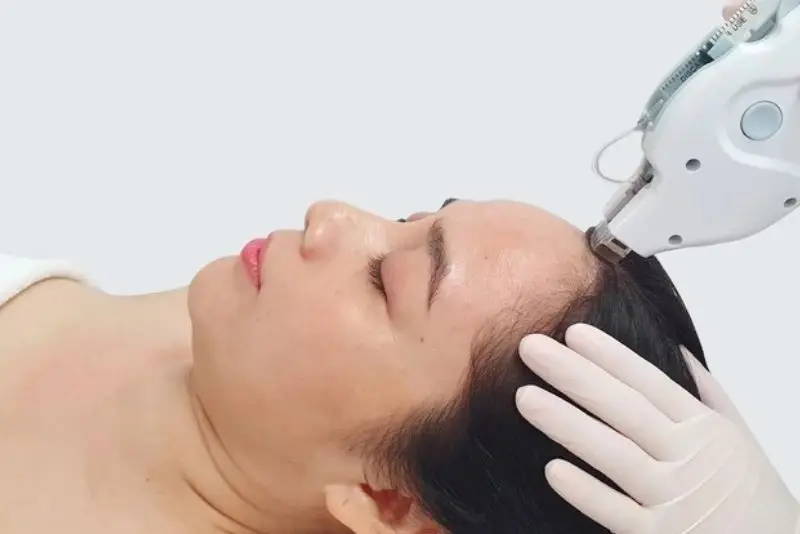 Meso Extra không kim cũng mang lại hiệu quả cao