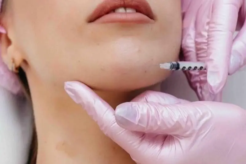Tiêm filler