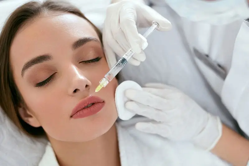 Tiêm botox giãn cơ nâng môi trên