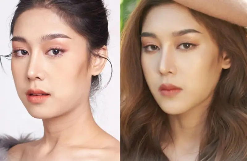 Cằm giúp điều chỉnh hài hòa giữa trán, mũi và môi, tạo nét đẹp chuẩn hiện đại