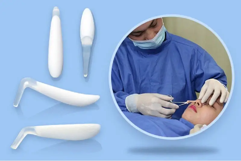 Nâng mũi sụn Mỹ là phương pháp