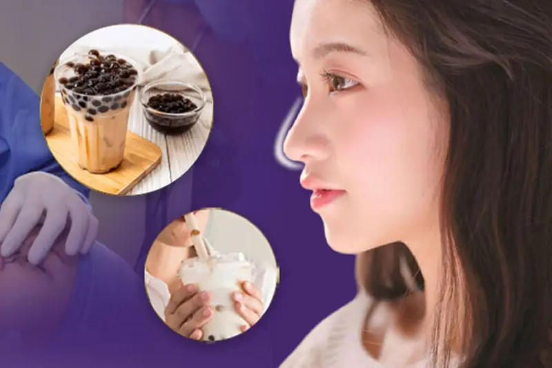 Sau nâng mũi nên hạn chế uống trà sữa