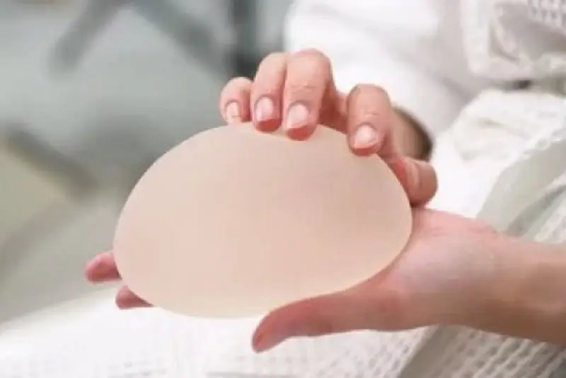 nâng ngực size 315