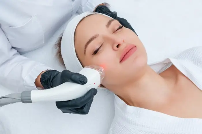 Tia laser có thể kích thích làn da sản sinh collagen
