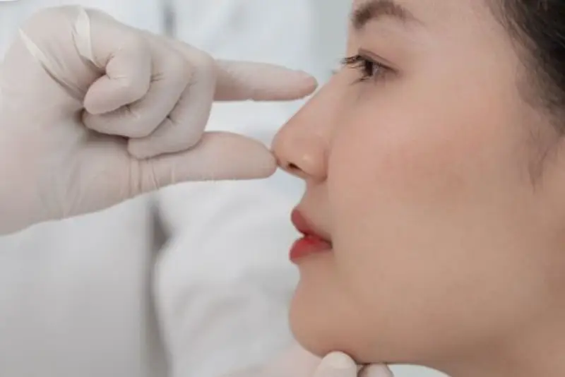 Chăm sóc đúng cách sau tiêm filler mũi để đảm bảo an toàn