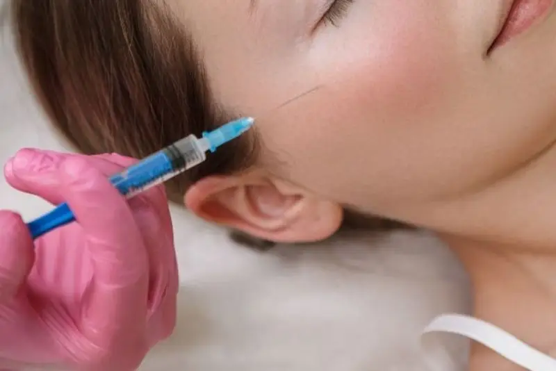 tiêm filler gò má