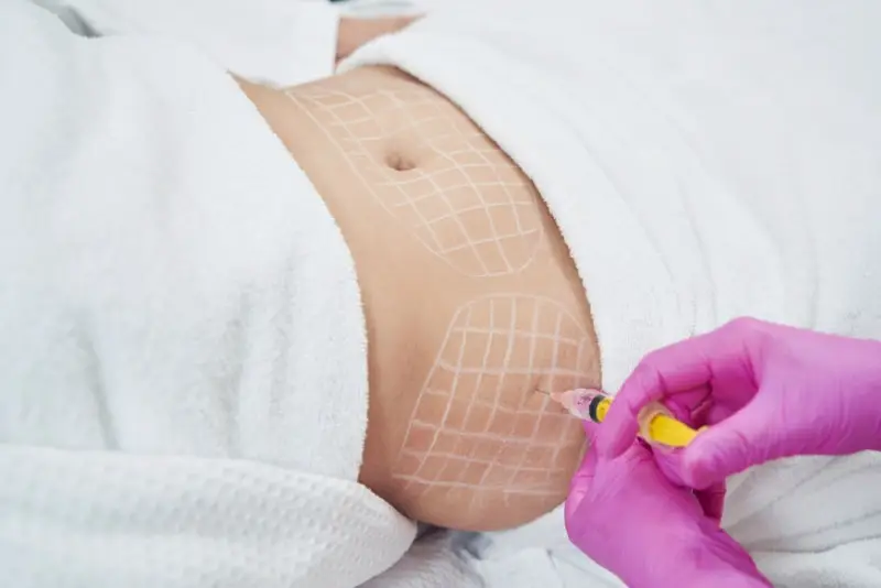 Tiêm tan mỡ bụng cần nhiều lần tiêm