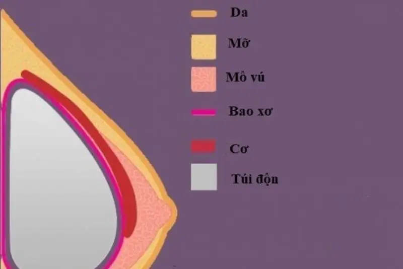 Bao xơ là lớp mô liên kết mỏng hình thành xung quanh túi độn