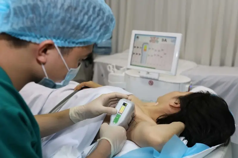 Công nghệ vi sóng dùng năng lượng để loại bỏ tuyến mồ hôi
