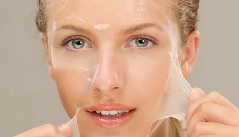 Phương pháp lột da hóa học tuyệt đối không được tự ý thực hiện tại nhà