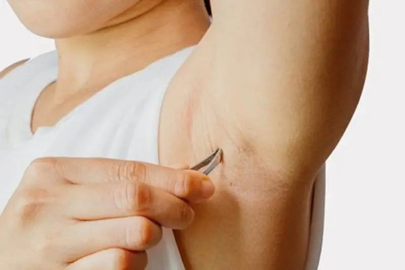 Nhổ lông nách bằng nhíp