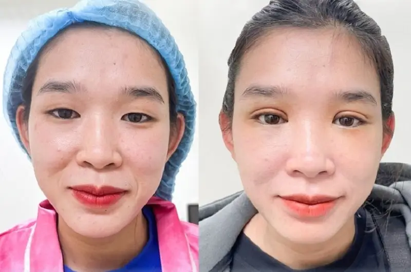 Mắt phượng hoàng phù hợp với nhiều trường hợp