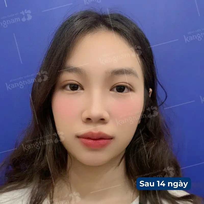 Mí mắt hài hòa với các đường nét trên khuôn mặt