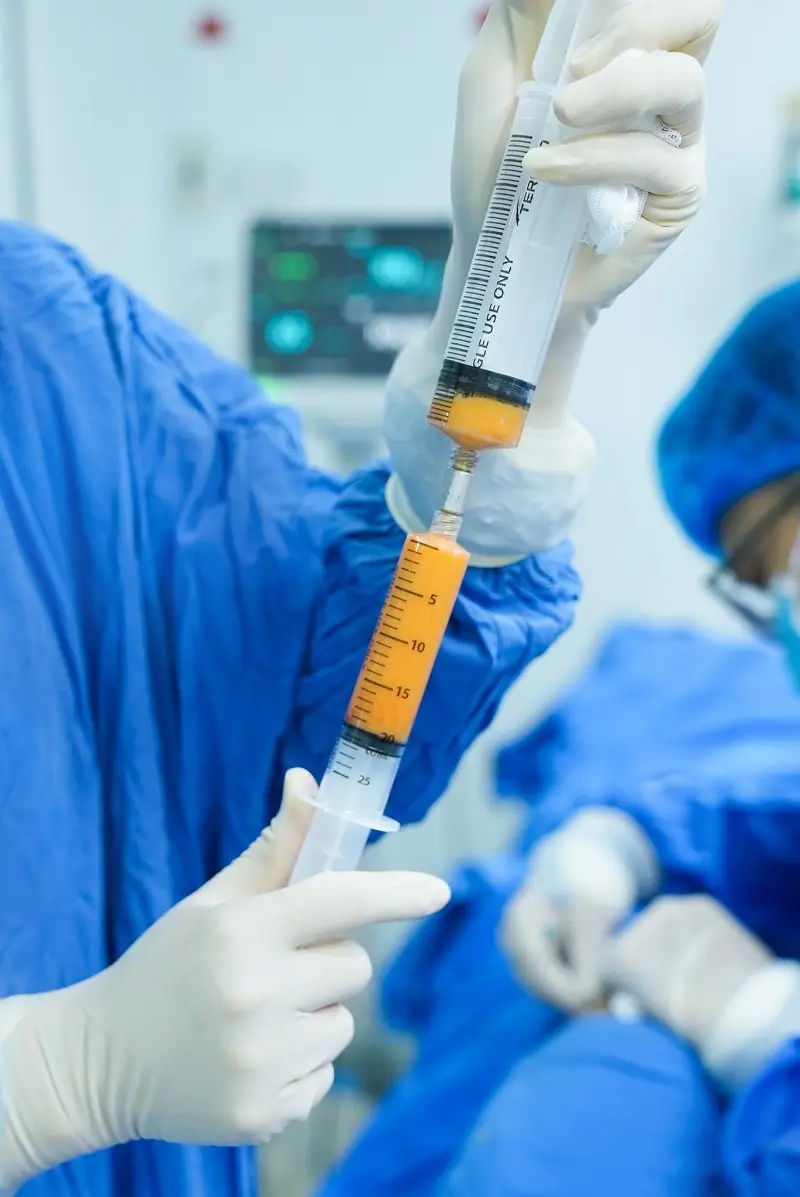 Kangnam thực hiện cấy mỡ vùng môi chuẩn y khoa