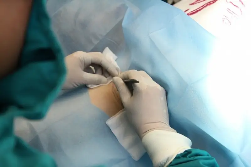 Mỗi phương pháp chưa hôi nách sẽ có mức giá khác nhau