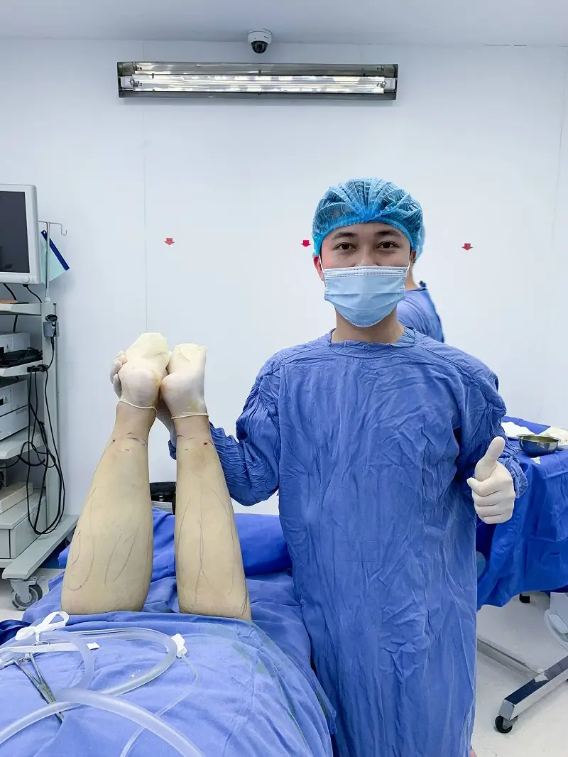 Hút mỡ bắp chân tại những địa chỉ uy tín giúp khách hàng đảm bảo an toàn và mang lại hiệu quả cao