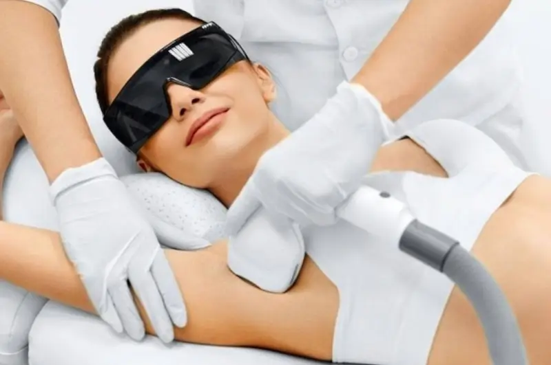 Trị hôi nách bằng laser không can thiệp xâm lấn