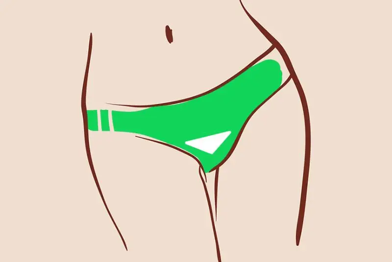 Triệt lông bikini kiểu Brazil