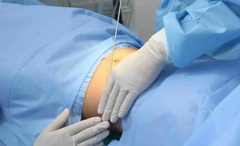 Lựa chọn địa chỉ thẩm mỹ uy tín để tránh những biến chứng xảy ra