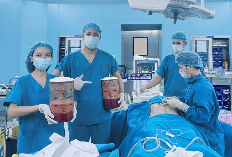 Đội ngũ bác sĩ 15 năm kinh nghiệm trực tiếp hút mỡ cho khách hàng