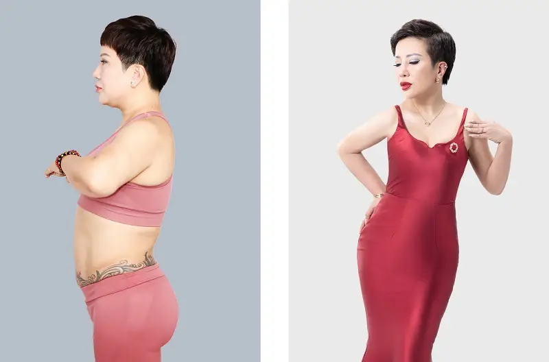 Khách hàng sở hữu vóc dáng thon gọn, sau khi trút sạch mỡ thừa