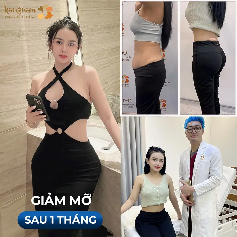 Tuân thủ theo hướng dẫn của bác sĩ sẽ giúp chị em sở hữu vóc dáng thon gọn như ý