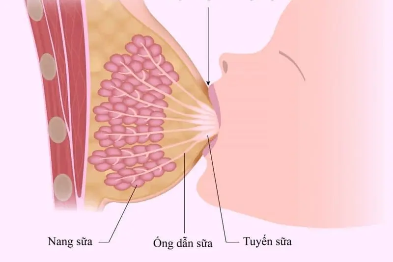 Nâng ngực không can thiệp vào tuyến sữa hay ống dẫn sữa