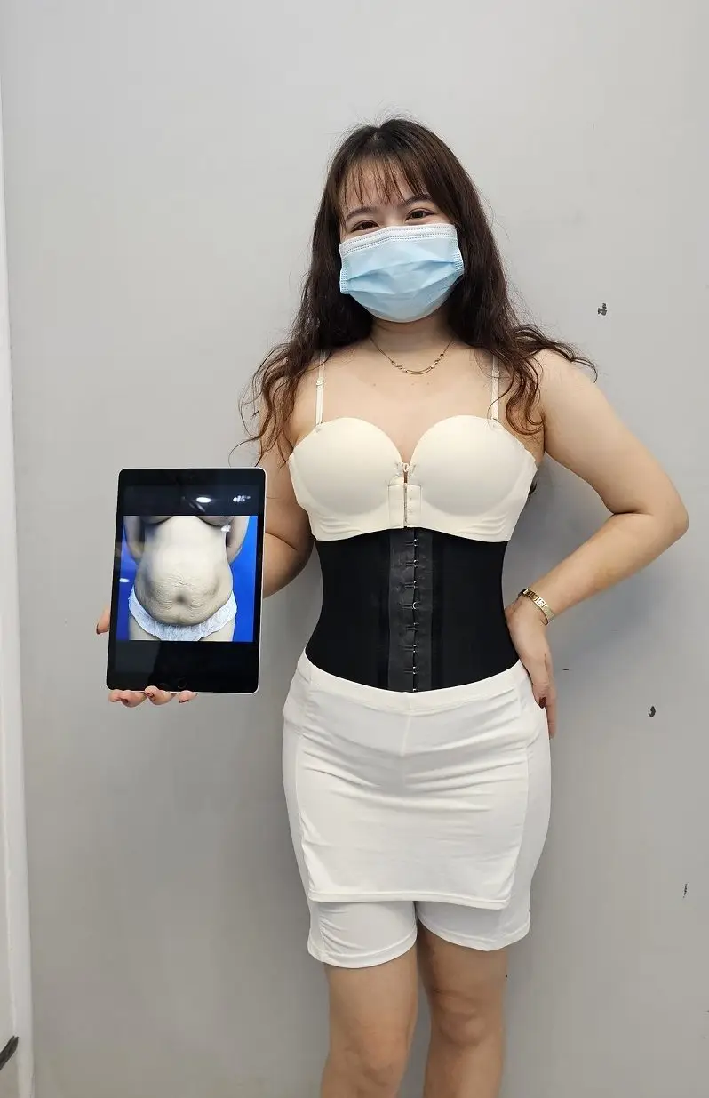 Nên đeo đai định hình vùng bụng để giúp vết thương nhanh phục hồi