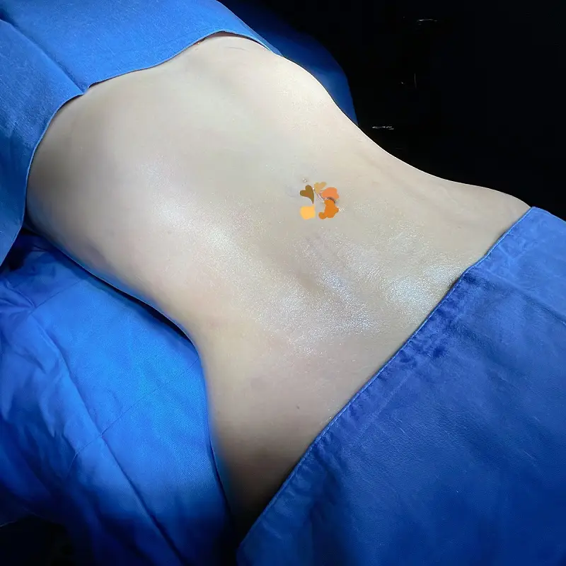 Chăm sóc vùng vết thương đúng cách để nhanh phục hồi