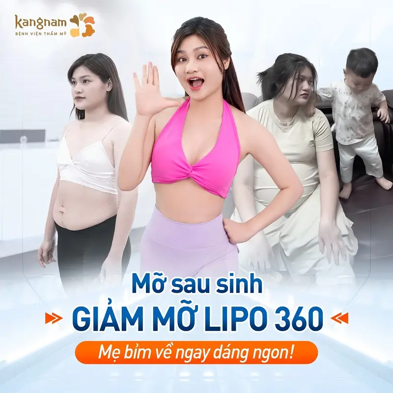 Giảm mỡ Lipo 360 giúp khách hàng loại bỏ mỡ thừa nhanh chóng