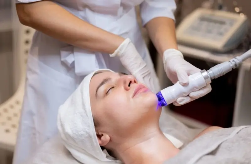 Điều trị sẹo lõm bằng laser tiên tiến, giúp da sáng mịn, lấp đầy sẹo rỗ