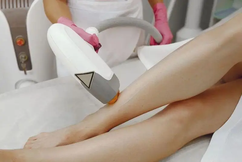 Triệt lông chỉ châm chích nhẹ trong thời gian ngắn