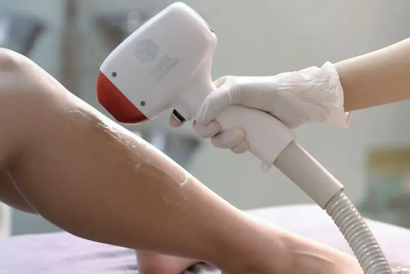 Triệt lông không đau khi thực hiện đúng kỹ thuật