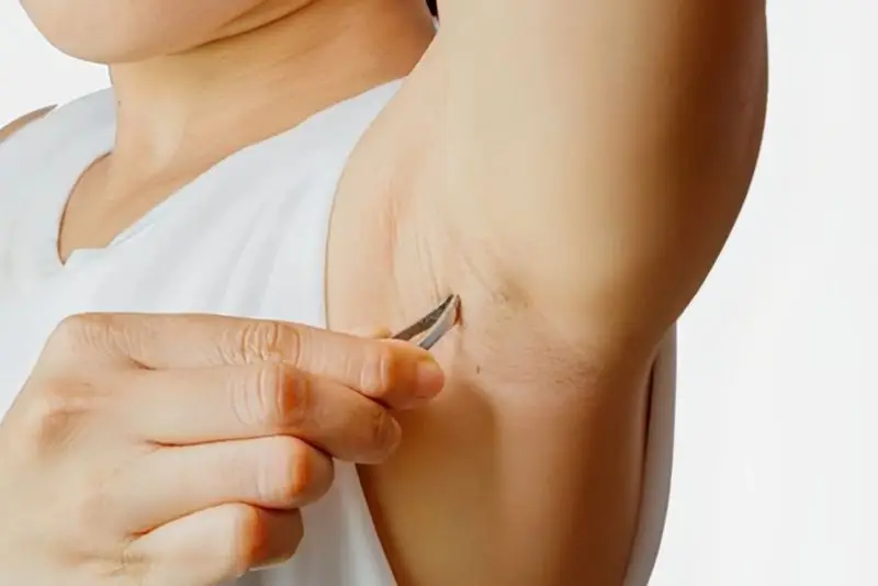 Tránh nhổ hoặc cạo lông