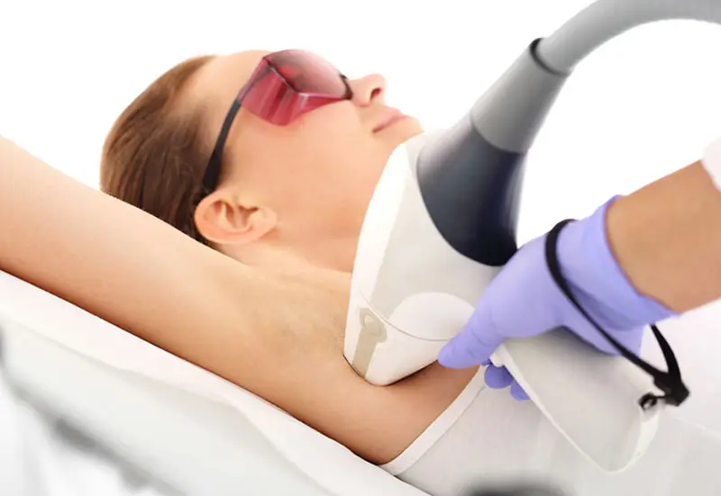 Triệt lông nách chỉ cần từ 10-15 phút