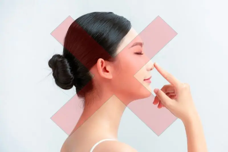 14 tuổi không được nâng mũi