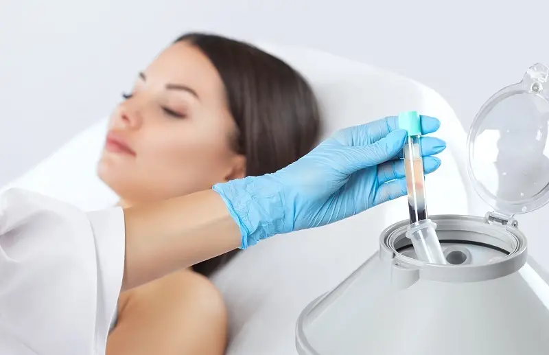 Công nghệ PRP sử dụng huyết tương của khách hàng