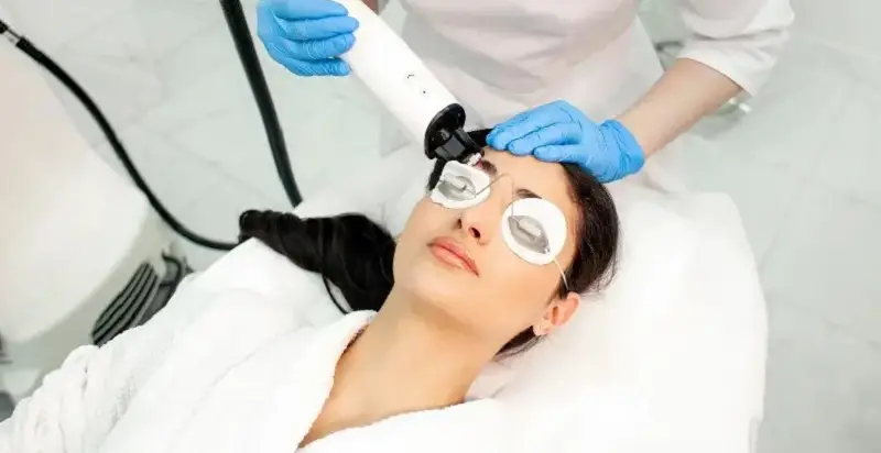 Sử dụng tia laser làm mờ vùng mí mắt bị sẹo lồi