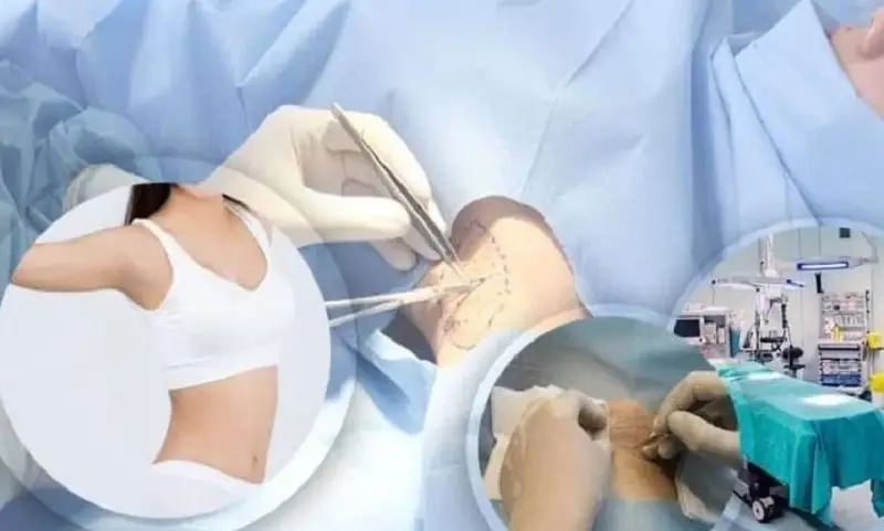 Quá trình cắt tuyến mồ hôi nách khách hàng sẽ không cảm thấy đau