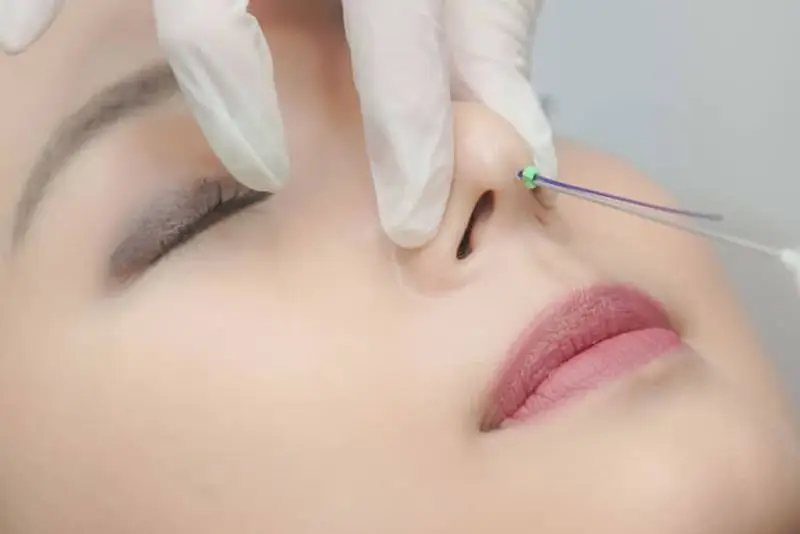 Cách chăm sóc ảnh hưởng đến kết quả căng chỉ