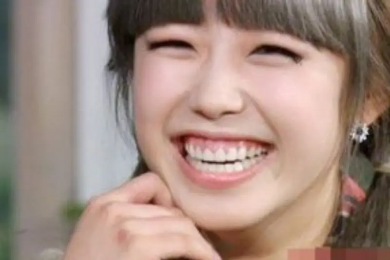 Con gái cười hở lợi bị cho là kém duyên