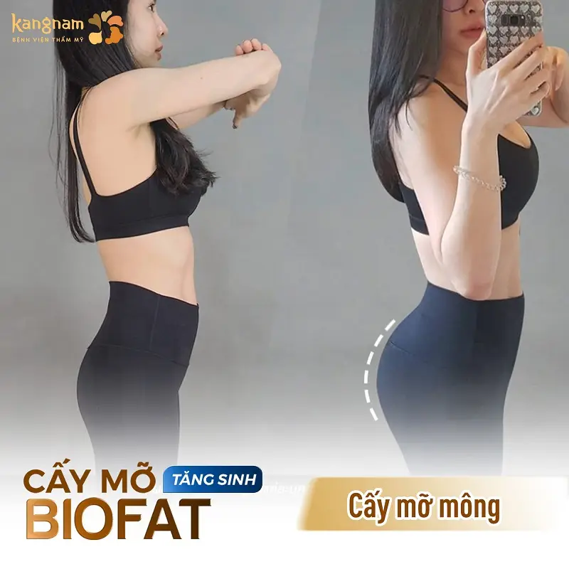 Khách hàng sở hữu vòng ba căng tròn, cân đối và rút ngắn thời gian phục hồi
