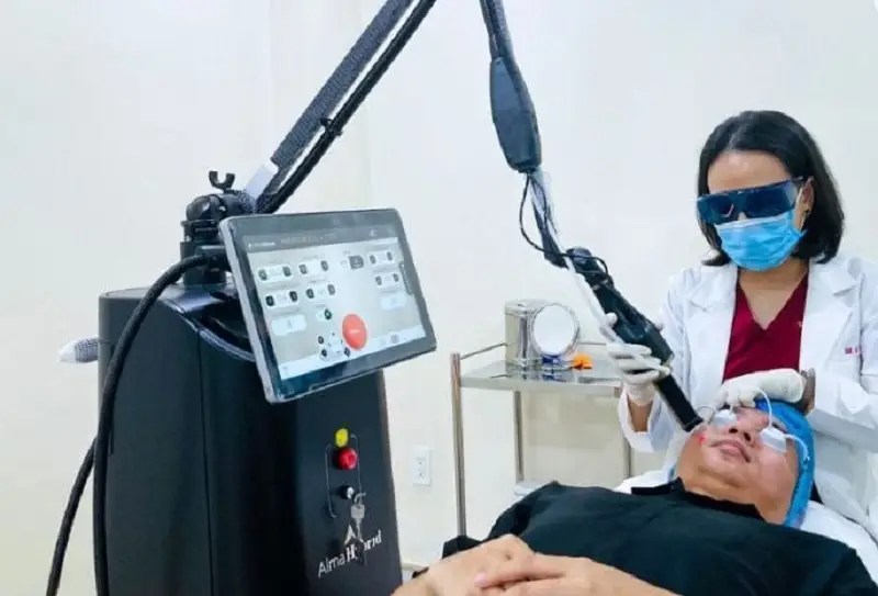 Điều trị sẹo lõm lâu năm bằng laser được nhiều bác sĩ ứng dụng cho khách hàng