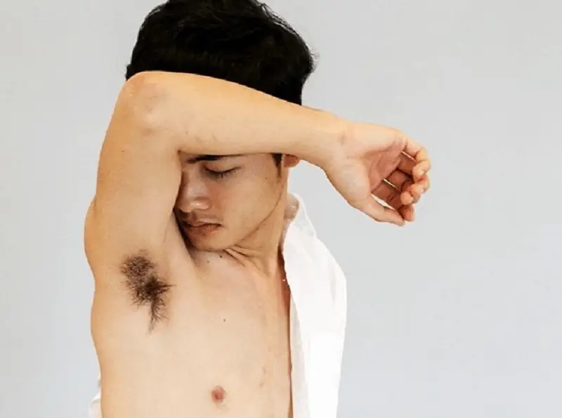 Mùi hôi nách không thể hết vĩnh viễn nếu không điều trị đúng cách